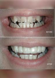 Before and After 5