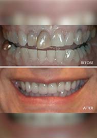 Before and After 7