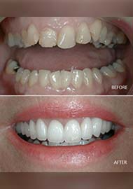 Before and After 8