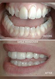 Before and After 9