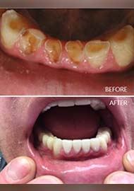 Before and After 12