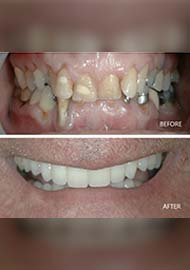 Before and After 13