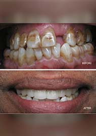 Before and After 14